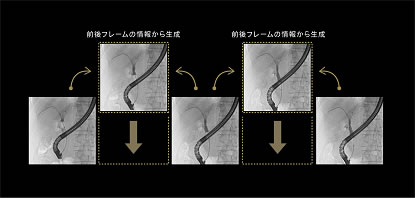 [摜]FRC̃C[W