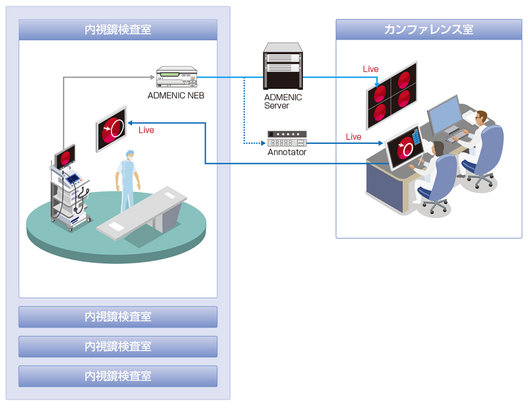 内視鏡システム