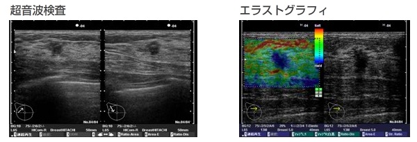 検査画像