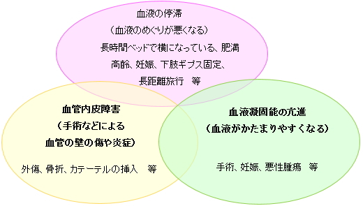 静脈塞栓症について