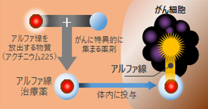 α線内用療法