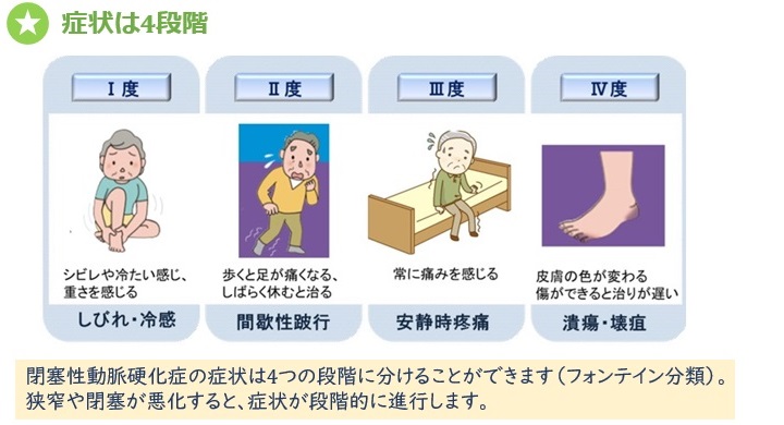 症状は4段階