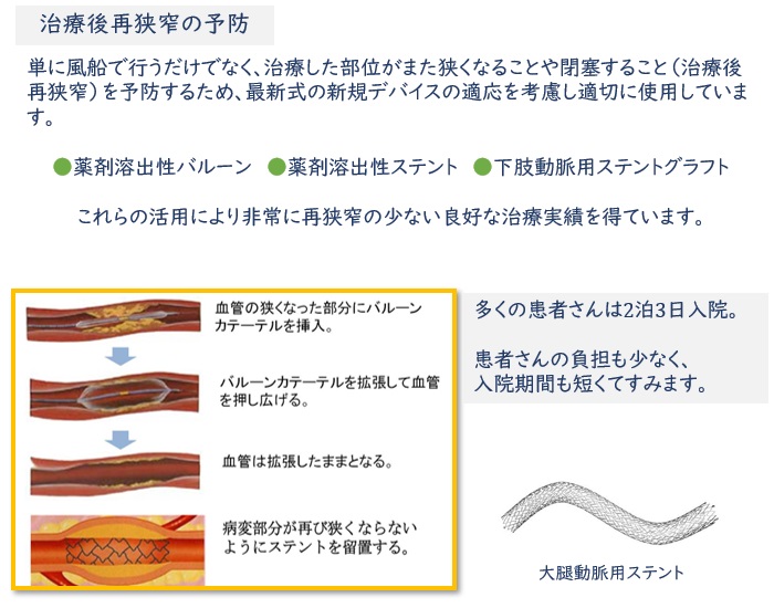 治療後再狭窄の予防