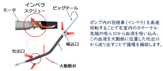 iMPELLAの仕組み