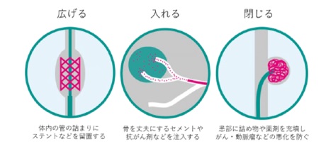 治療の範囲