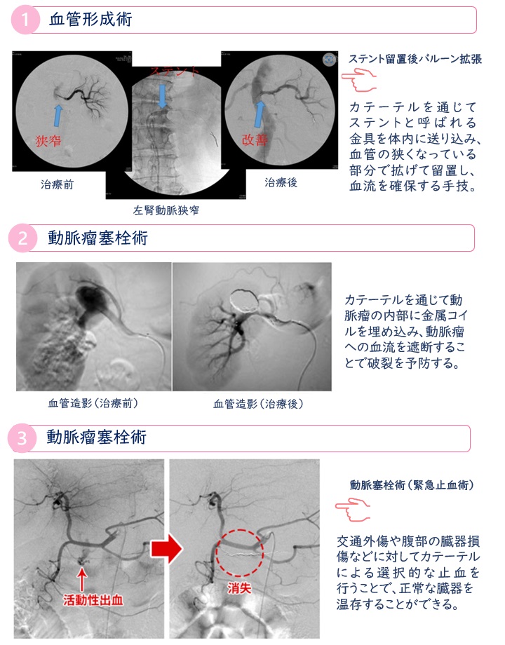 IVRの活躍する主な場面