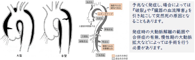 発症イメージ