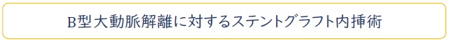 B型大動脈解離に対するステントグラフト内挿術