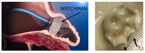 WATCHMAN
